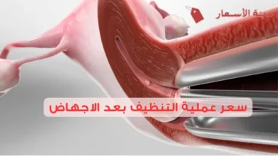سعر عملية التنظيف بعد الاجهاض 2025 وما هو الفرق بين التنظيف الجراحي والشفط؟