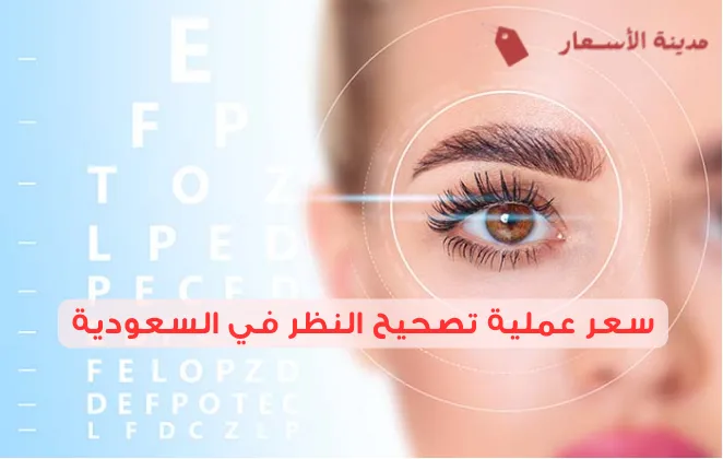 سعر عملية تصحيح النظر في السعودية 2025 هل عملية تصحيح النظر آمنة؟