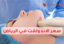 سعر الاندولفت في الرياض 2025: هل الاندولفت مناسب لكل الأشخاص؟