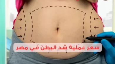 سعر عملية شد البطن في مصر 2025: تكاليف خفية يجب الانتباه لها