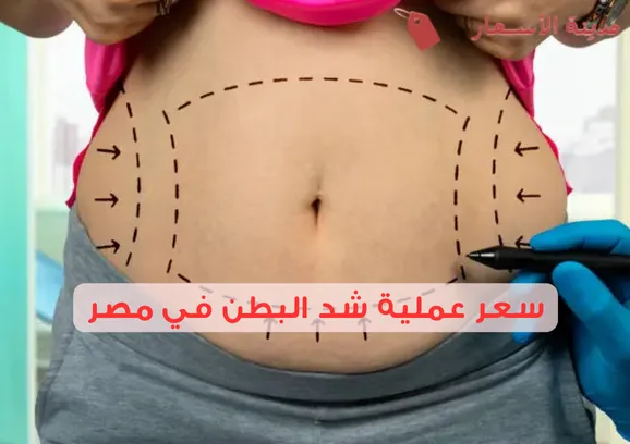 سعر عملية شد البطن في مصر 2025: تكاليف خفية يجب الانتباه لها