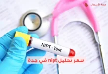 سعر تحليل nipt في جدة 2025 وأماكنه