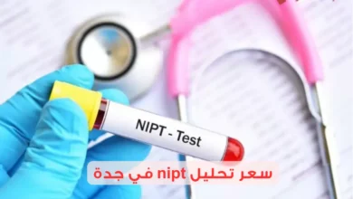 سعر تحليل nipt في جدة 2025 وأماكنه