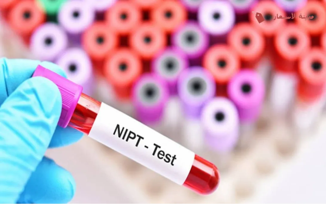 ما هو تحليل NIPT؟