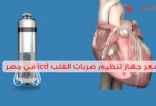 سعر جهاز تنظيم ضربات القلب icd في مصر: مقارنة بين الأنواع
